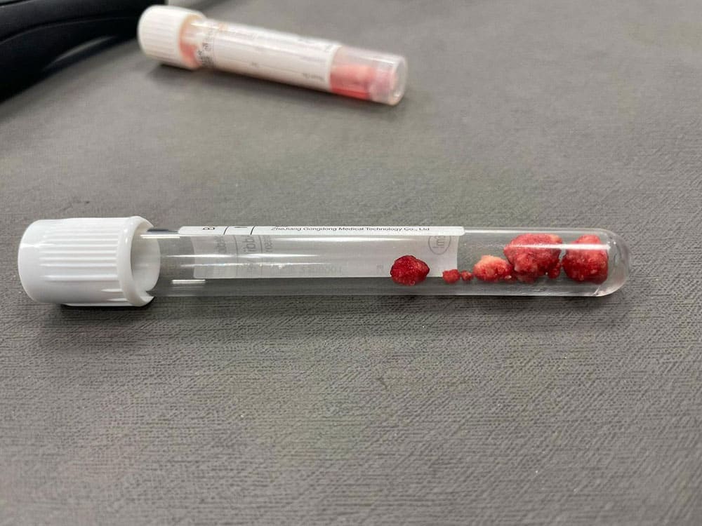 A clear test tube containing small reddish stones—reminiscent of the crystals found in studies of hyperthyroidism in cats—is placed on a gray surface. In the background, another test tube holds a reddish substance, hinting at scientific exploration.