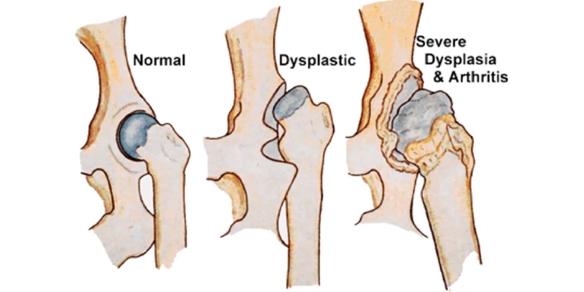 Hip Dysplasia in Dogs Causes, Prevention and Treatment
