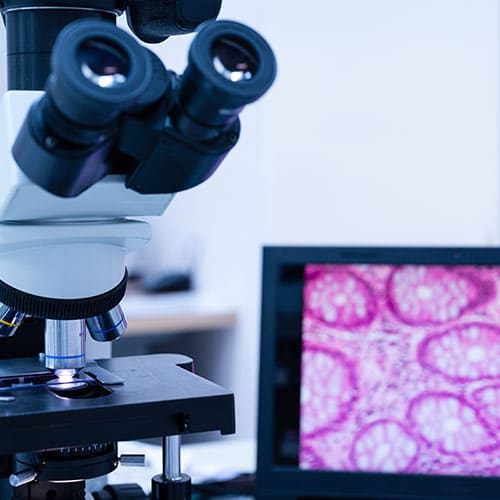 A close-up of a microscope next to a computer monitor displaying a magnified pink and purple cellular image, suggesting a laboratory or scientific research setting.
